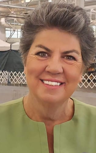 Customer photo review of Spare Veneers
