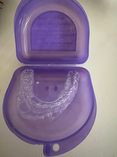 Customer photo review of File Your Smile (A Digital Copy of Your Impressions For Future Replacement Products)