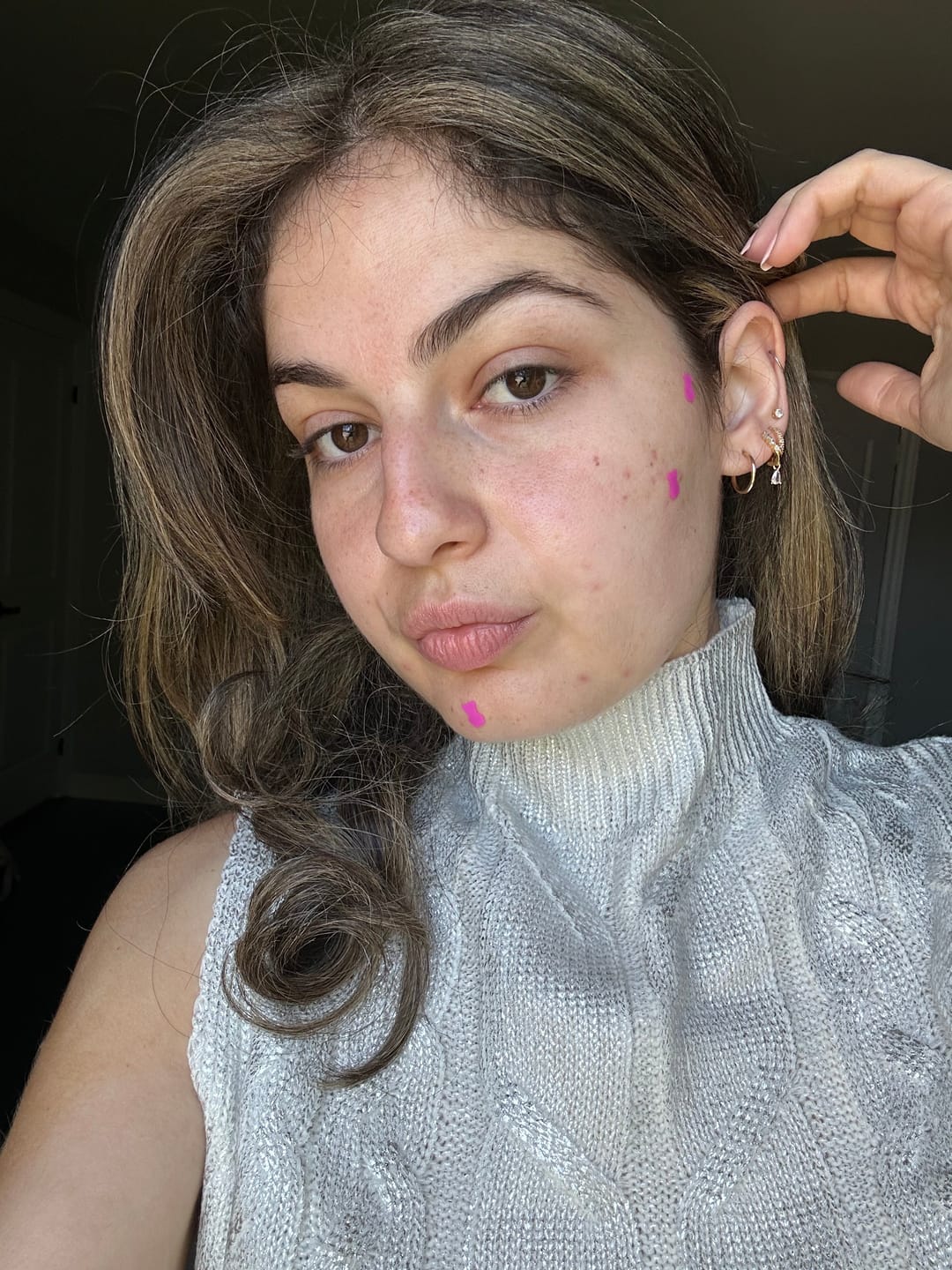 Customer photo review of Pimple Patches with Salicylic Acid - 72 Pink Teddies
