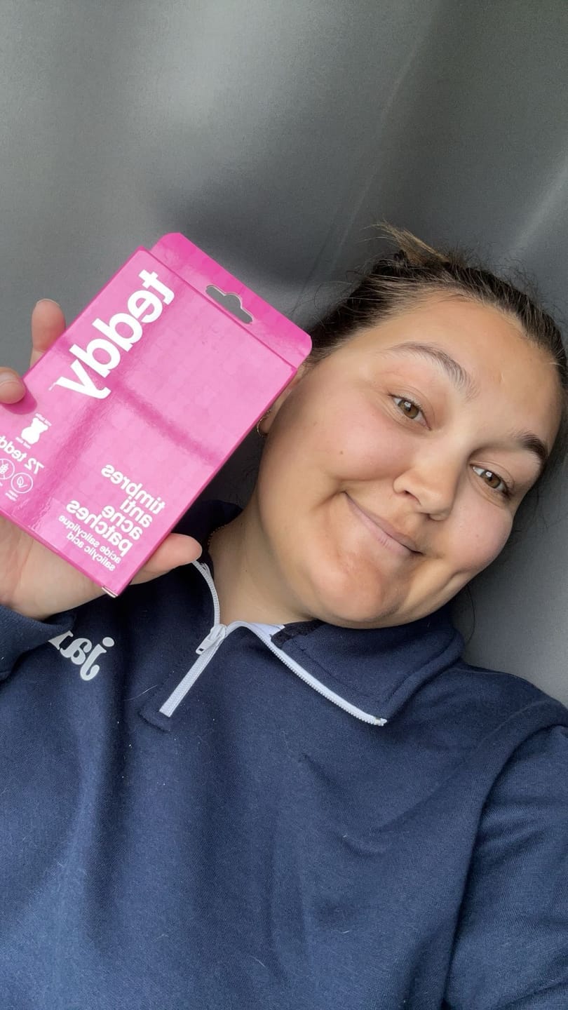 Customer photo review of Pimple Patches with Salicylic Acid - 72 Pink Teddies