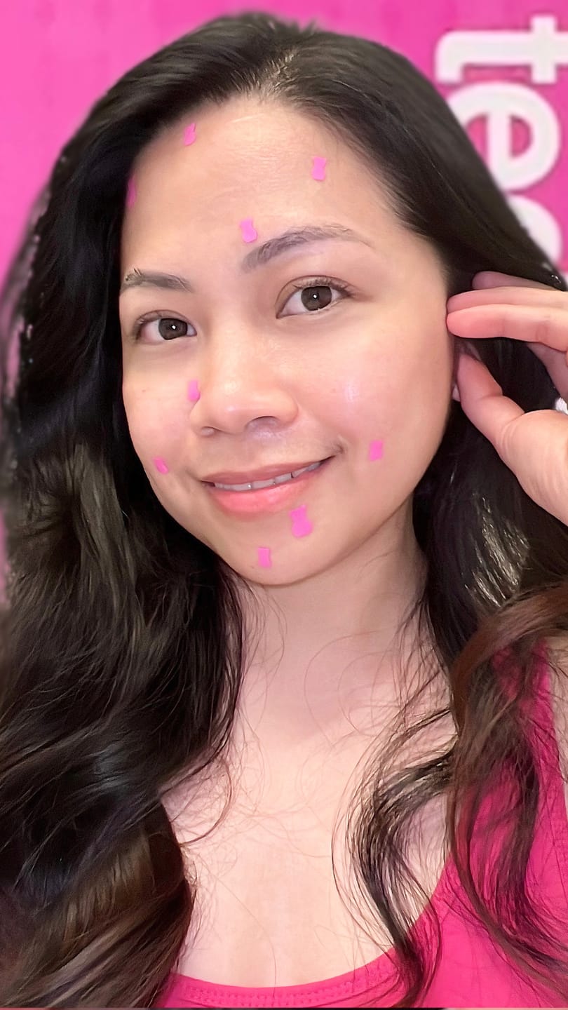 Customer photo review of Pimple Patches with Salicylic Acid - 72 Pink Teddies