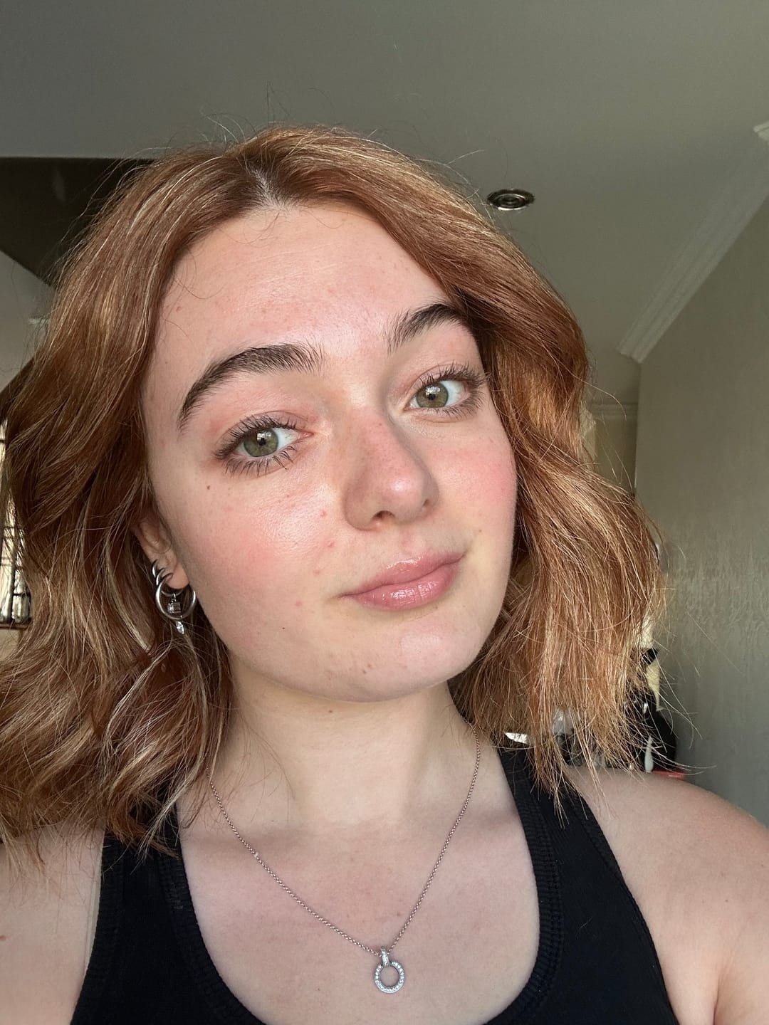 Customer photo review of Pimple Patches with Salicylic Acid - 72 Pink Teddies