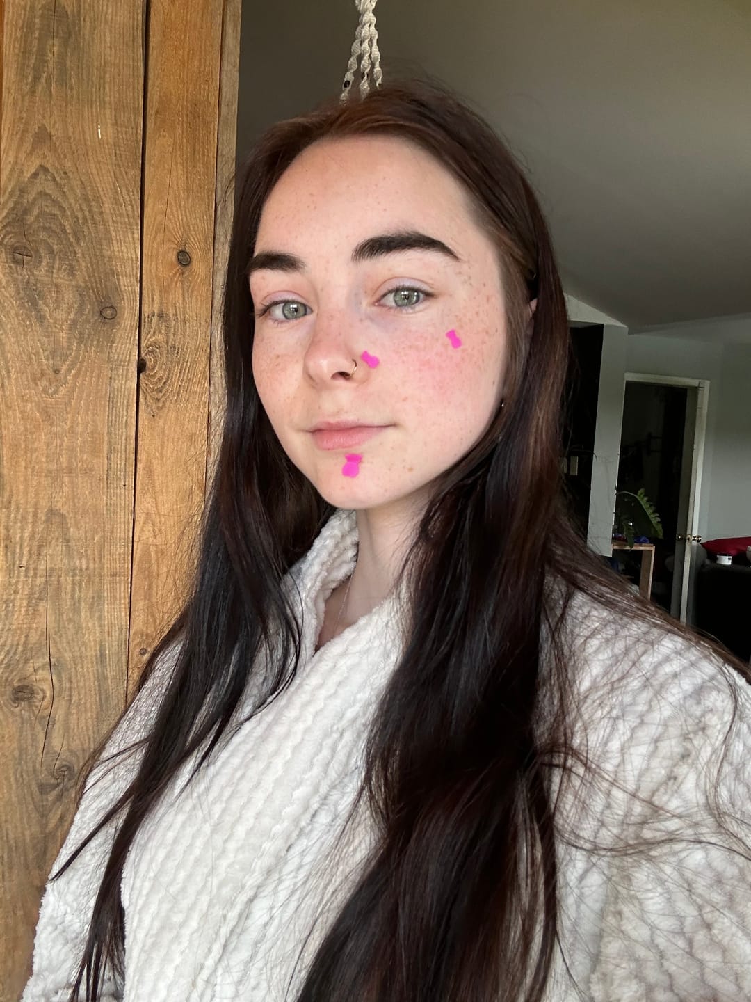 Customer photo review of Pimple Patches with Salicylic Acid - 72 Pink Teddies