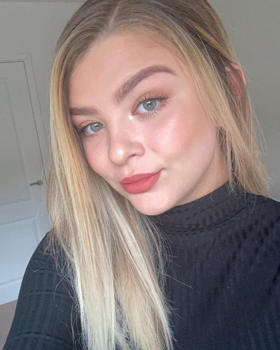 Customer photo review of SkinGlow™ Комплект за Дермапланинг
