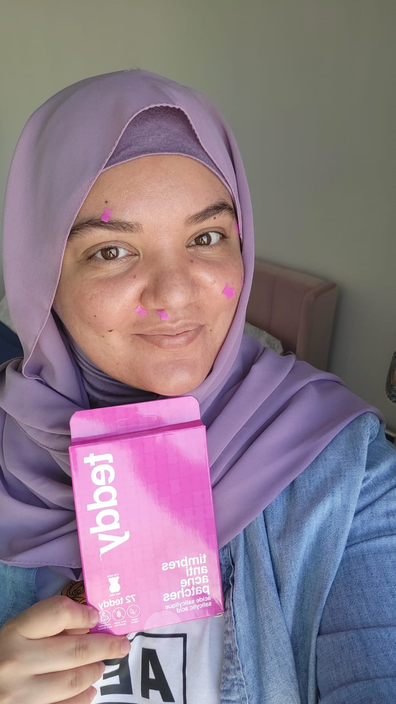 Customer photo review of Pimple Patches with Salicylic Acid - 72 Pink Teddies