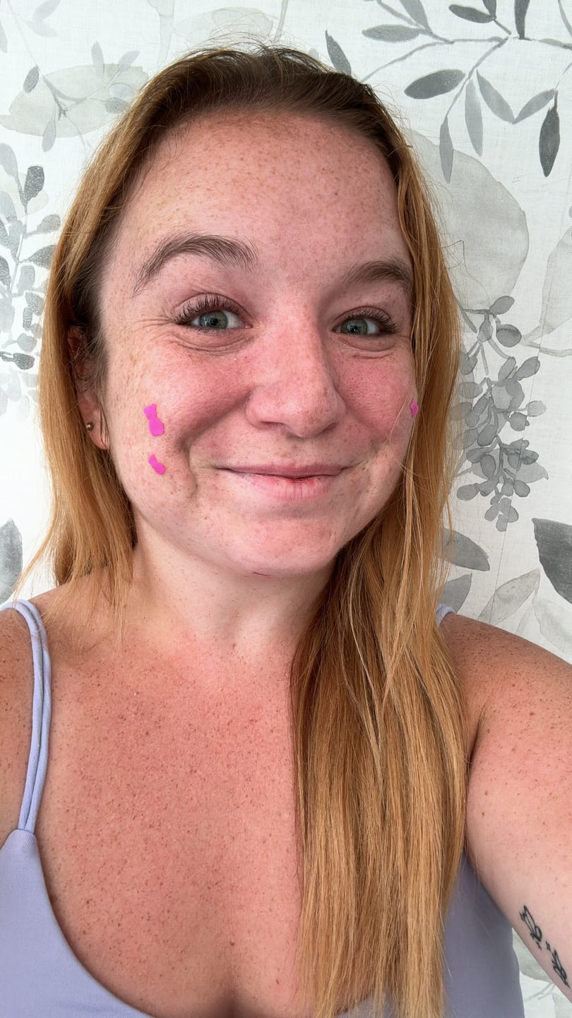 Customer photo review of Pimple Patches with Salicylic Acid - 72 Pink Teddies