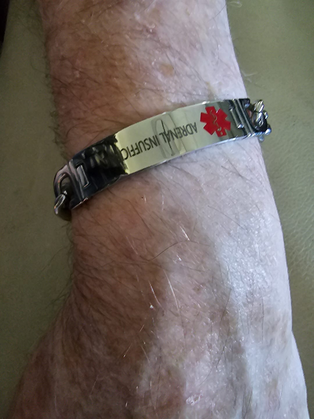 Customer photo review of Stainless Steel Medical Alert ID Chain Bracelet