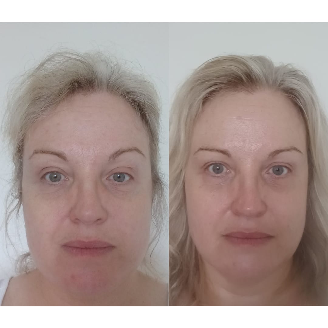Customer photo review of Anti-Fatigue Eye Mask