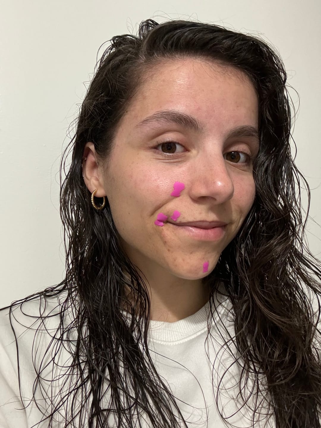 Customer photo review of Pimple Patches with Salicylic Acid - 72 Pink Teddies
