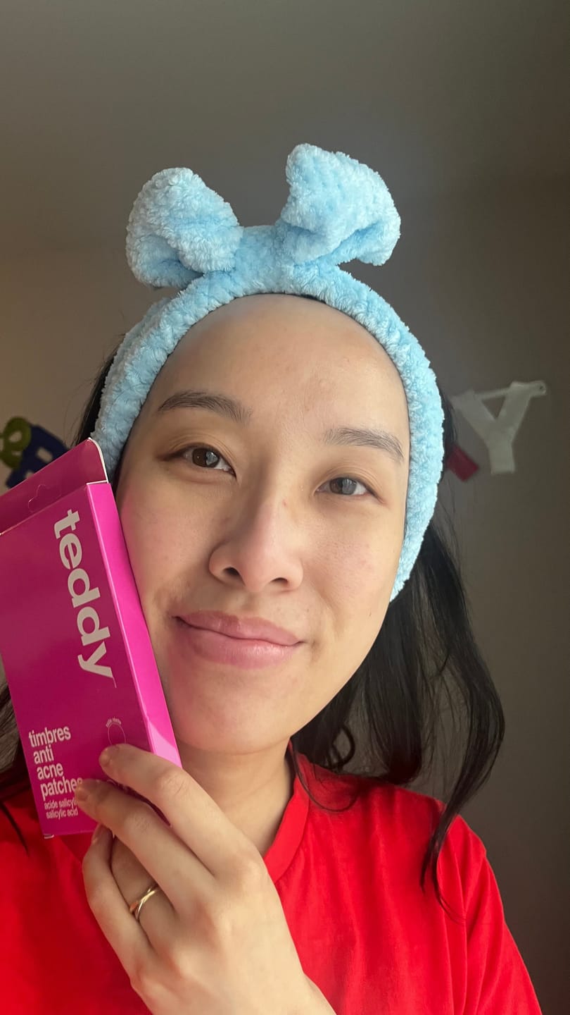 Customer photo review of Pimple Patches with Salicylic Acid - 72 Pink Teddies