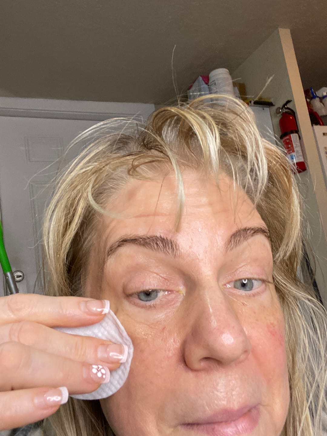 Customer photo review of Glow Peel Pads