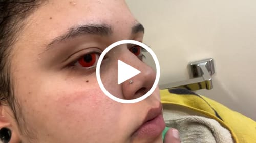 Customer video review of Finley x Eyemoody Pure Red | 6 Months, 2 pcs
