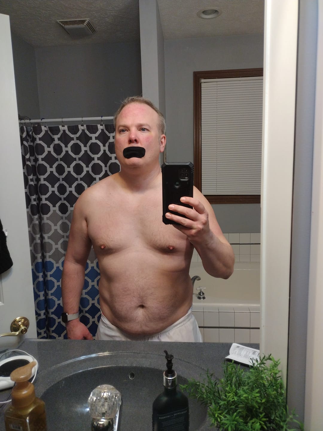 Customer photo review of Hostage Mouth Tape