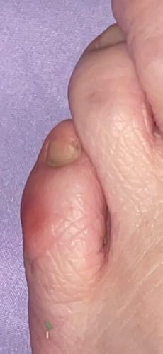 Customer photo review of Mama Bear Pregnancy Lotion