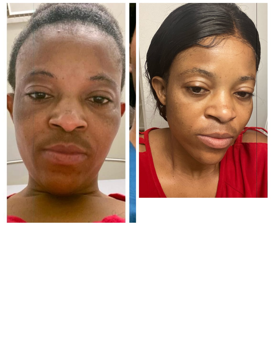 Customer photo review of Dark Spot Eraser Lotion