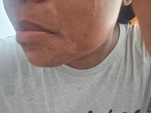 Customer photo review of LIMITED EDITION KIT Jolie’s Mini Full Body & Face Brightening Kit