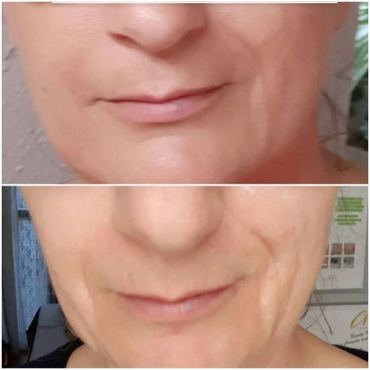 Customer photo review of SQT Revitalizing Starterset inkl. Online Schulung