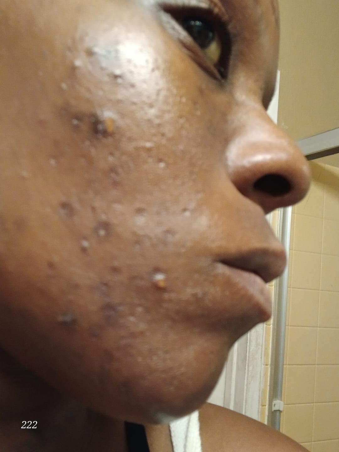 Customer photo review of Dark Spot Corrector Serum