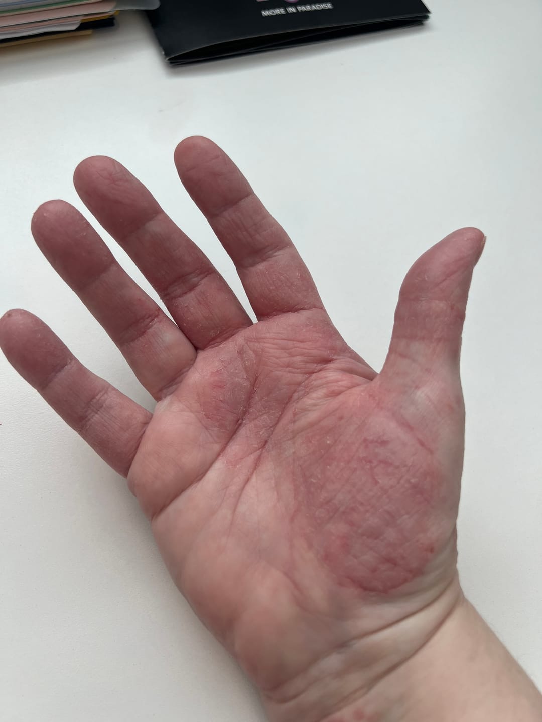 Customer photo review of liquid gold • anti-aging active serum