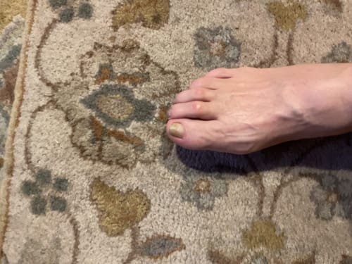 Customer photo review of Pentachom Photodynamic Laser Enhancer