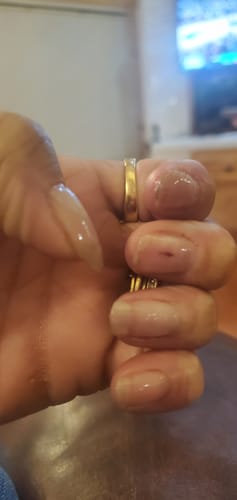 Customer photo review of Rocket Nail Fuel Nail Repair - Purple