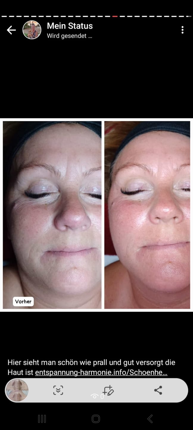 Customer photo review of SQT Anti-Aging Starterset inkl. Online Schulung