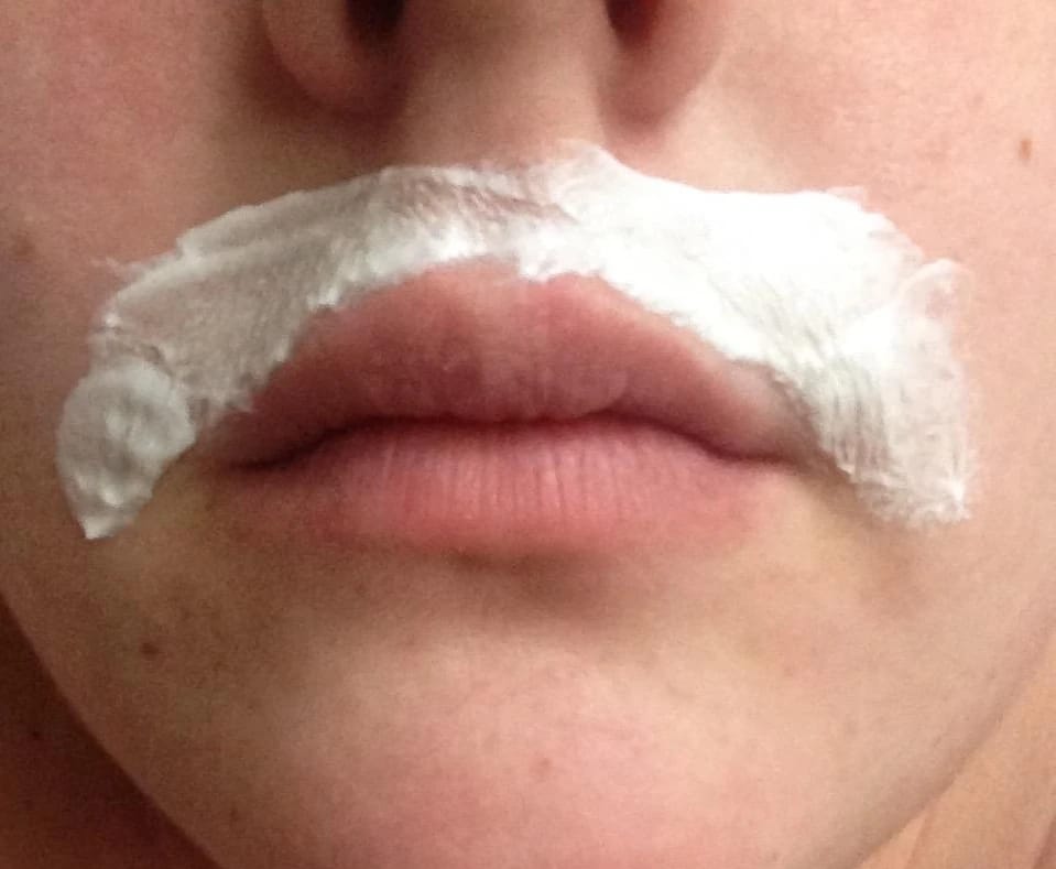 Customer photo review of Instant Hair Removal Kit