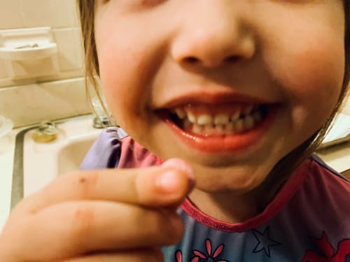 Customer photo review of Dental Probiotic - Strawberry