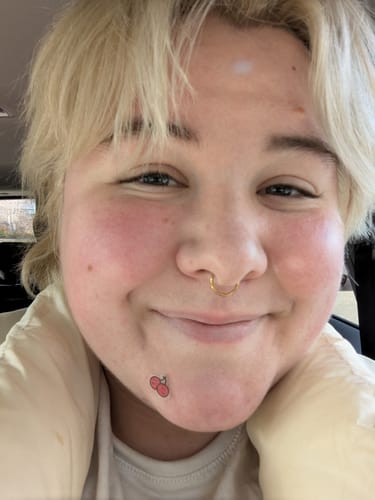 Customer photo review of FRUIT PARTAY (WITH TEA TREE OIL)