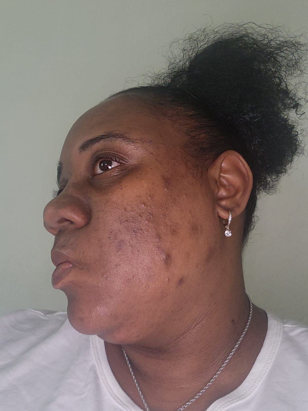 Customer photo review of PURIFYING SERUM