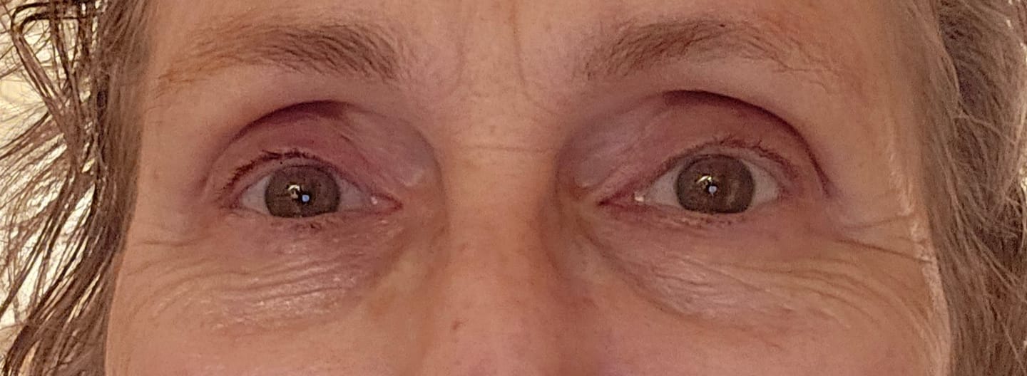 Reseña fotográfica de un cliente sobre el bálsamo para ojos