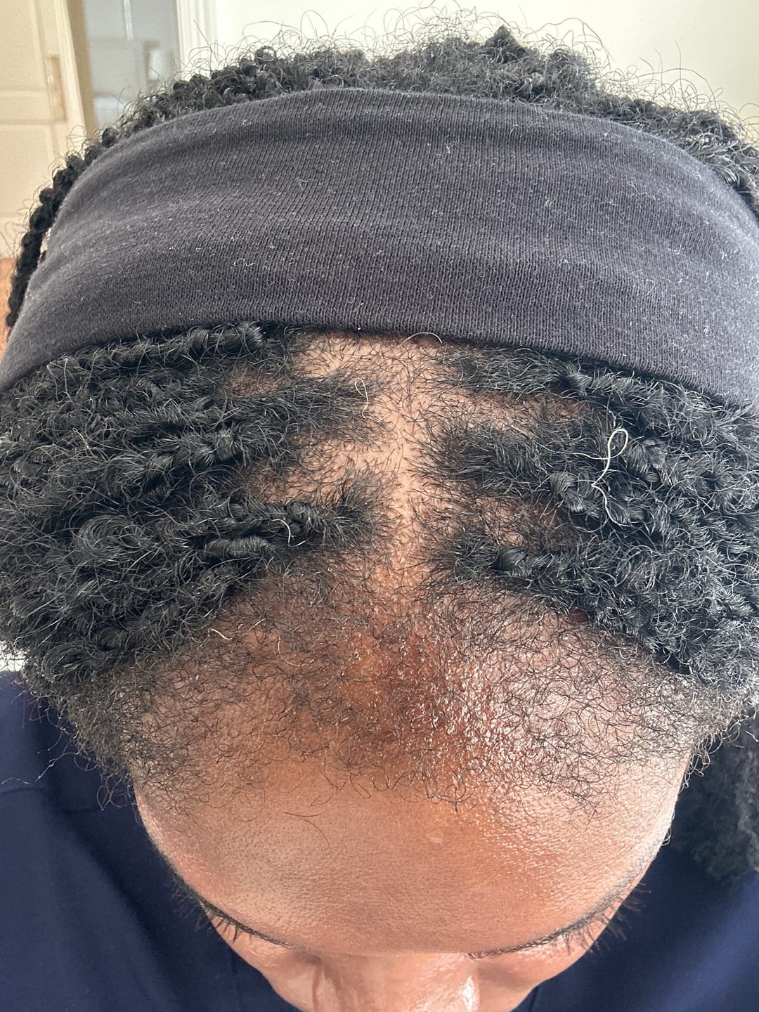 Customer photo review of Gashee Botanical Hair Pomade - Majestic