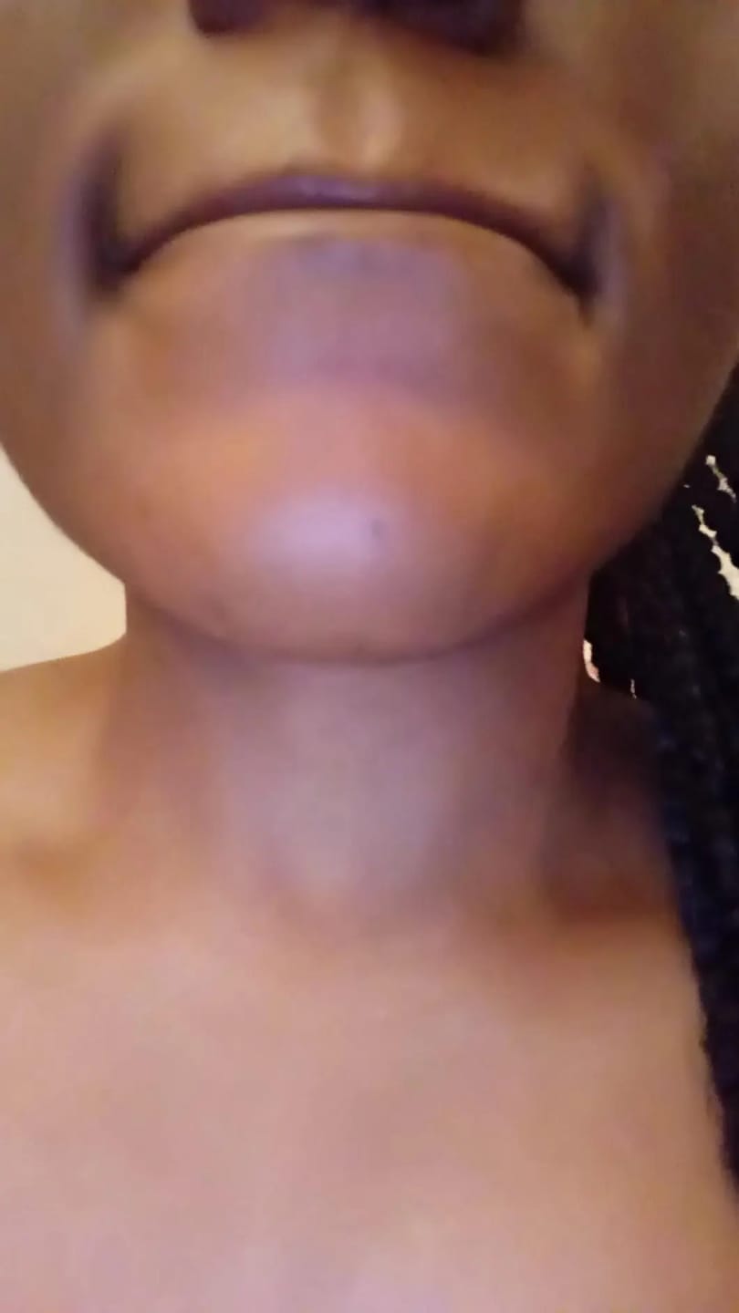 Customer photo review of Instant Hair Removal Kit