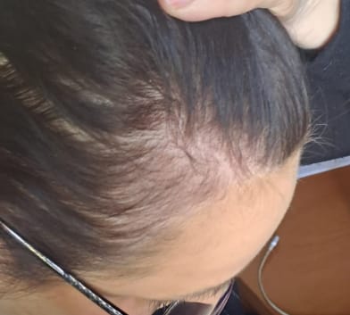 Customer photo review of Hair & Nail Capsules