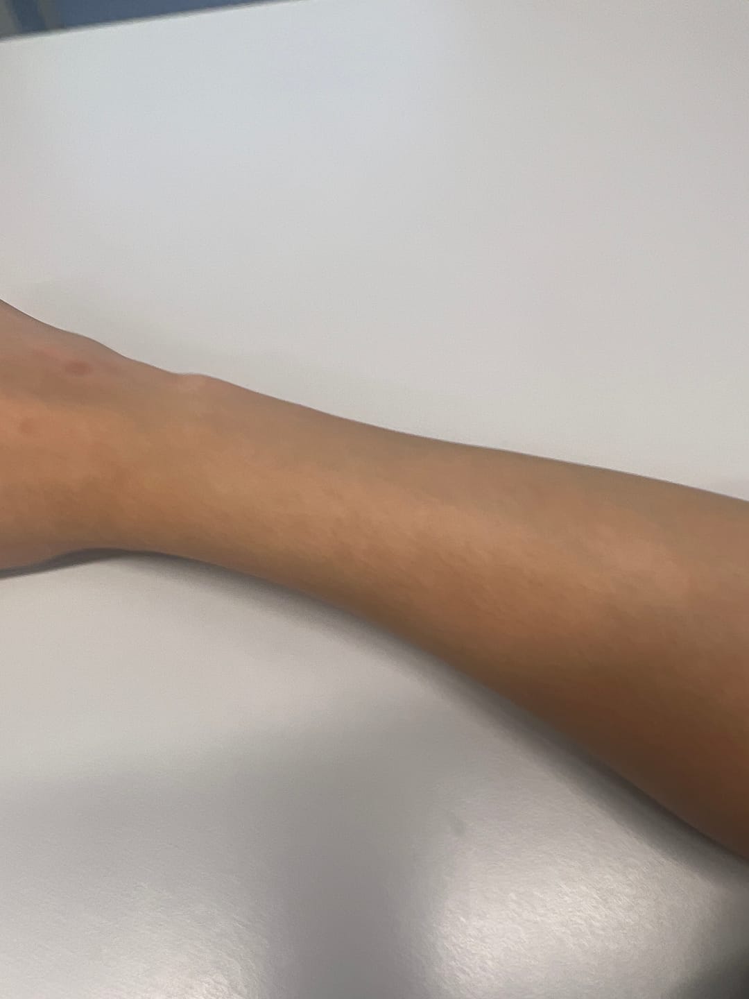 Customer photo review of Ulike Air10 家用脫毛儀
