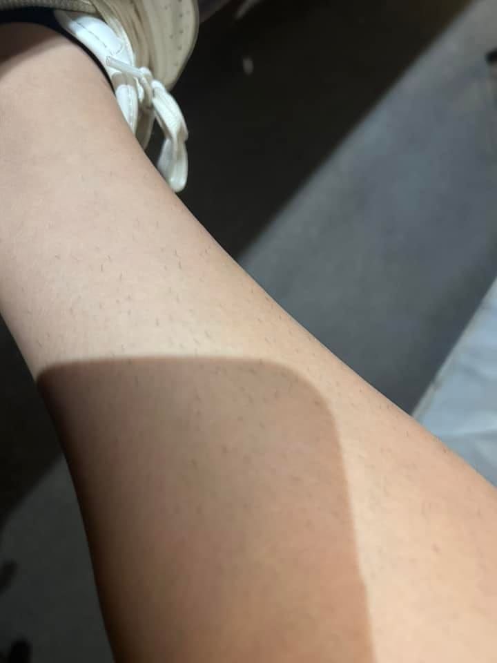 Customer photo review of SkinUp Clásica
