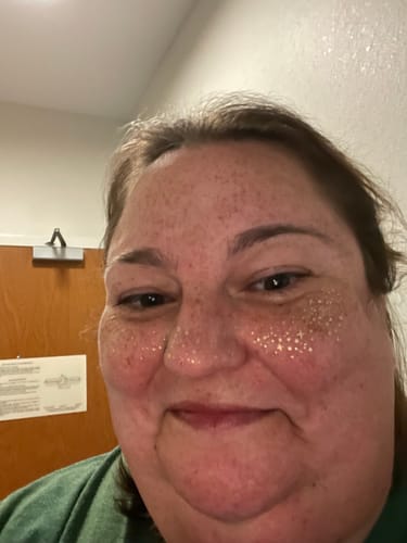 Customer photo review of Gold Glitter Freckles Makeup Patches
