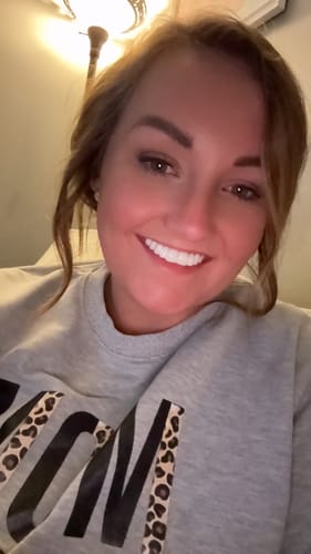 Customer photo review of Pop On Veneers with Impression Kit