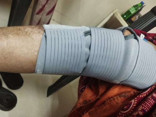 Customer photo review of Functional Knee Support | Provides moderate support & stability to the Knee | Color - Black (Single Piece)