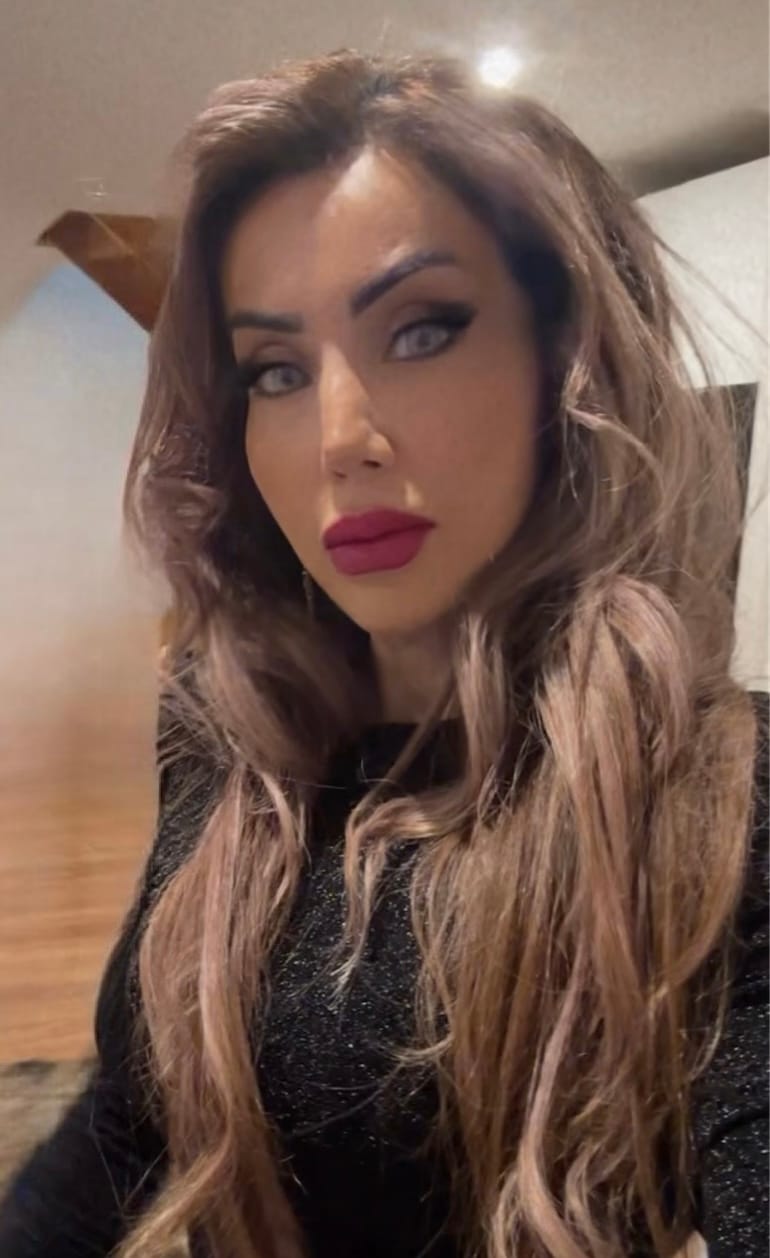 Customer photo review of Olivia Gray Colored Contact Lenses