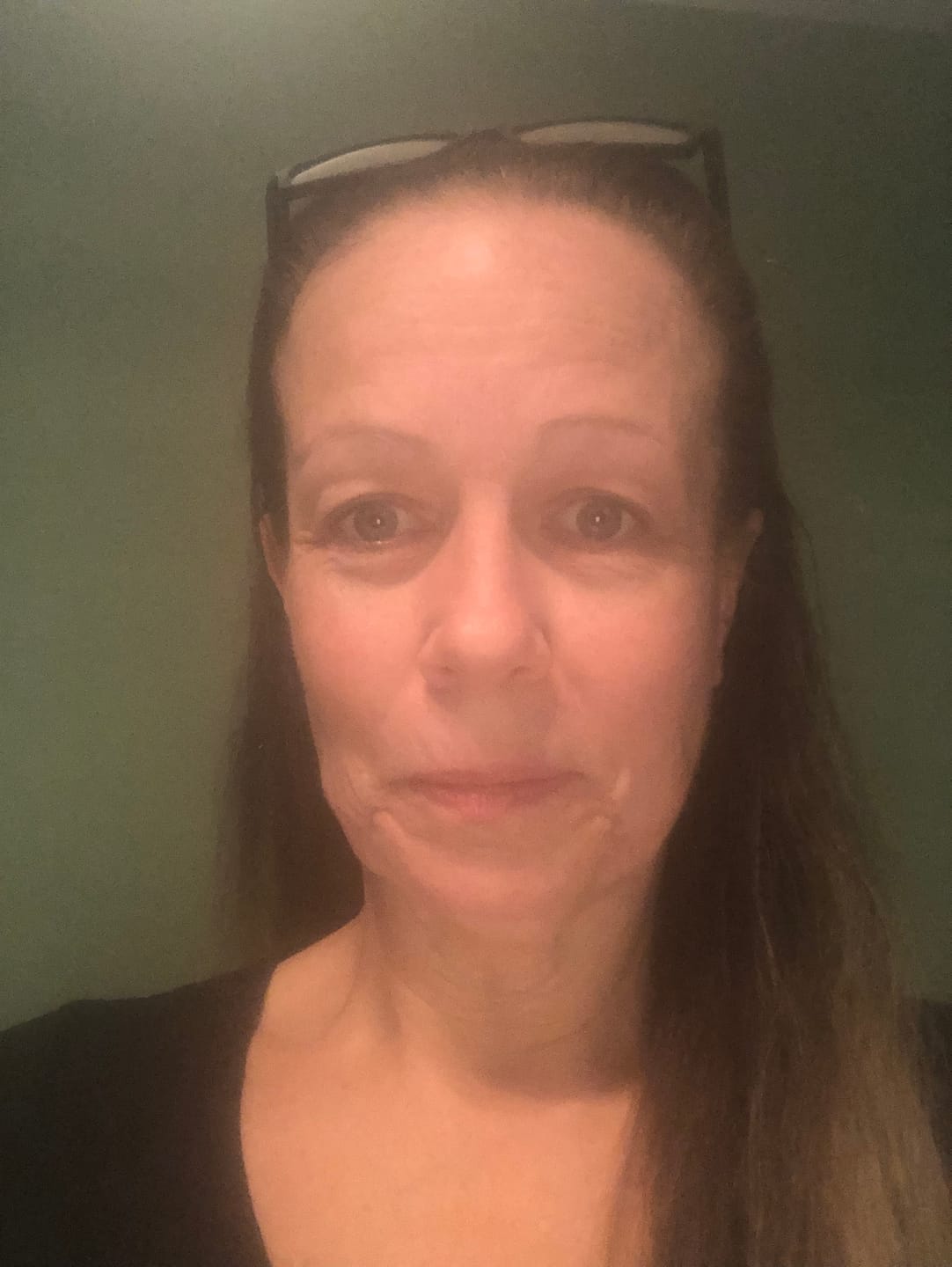 Customer photo review of Firming Eye Contour Cream (FREE)