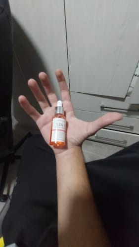 Customer photo review of JaySuing Mist: 5 In 1 Vitamin C Hyaluronic Acid Facial Serum for Skin Care