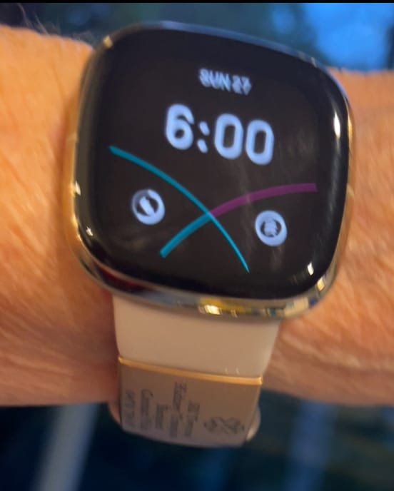 Customer photo review of Personalised ID Tag for Watch Band & Fitness Trackers