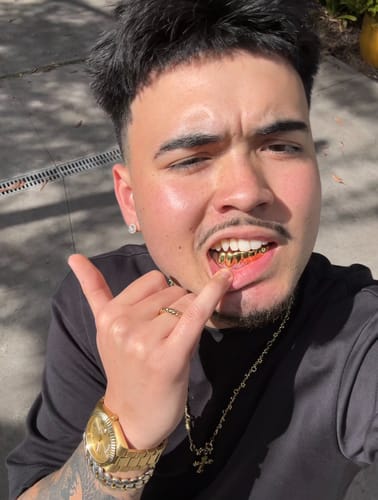 Customer photo review of SCORCH (GOLD GRILLZ)