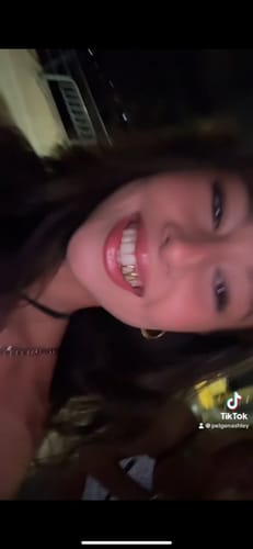 Customer photo review of SPARK (GOLD PLATED GRILLZ)