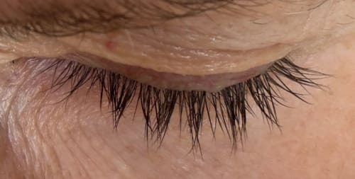 Customer photo review of COSTIQ® LASH SERUM