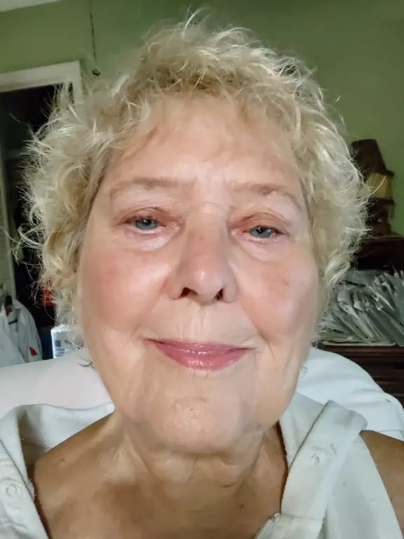 Customer photo review of Whipped Tallow Moisturizer