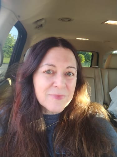 Customer photo review of Tirzepatide Weight Loss Program (Three Months)