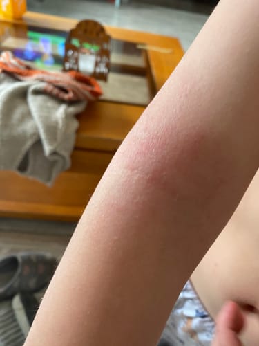 Customer photo review of Emulsión Recuperadora
