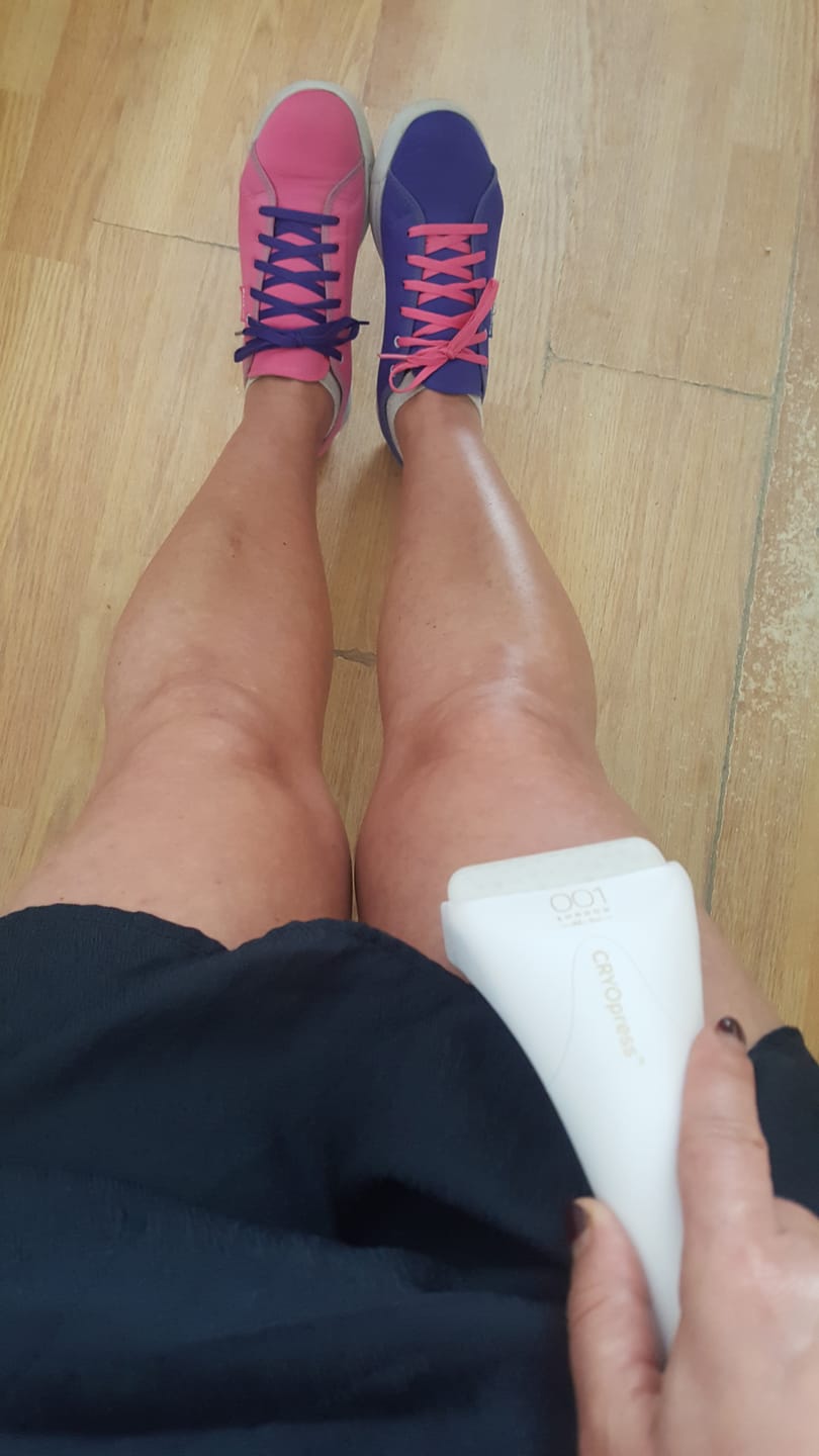 Customer photo review of CRYOpress®